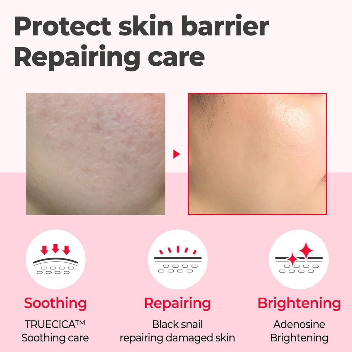 [SOME BY MI] Snail Truecica Miracle Repair Serum 50ml