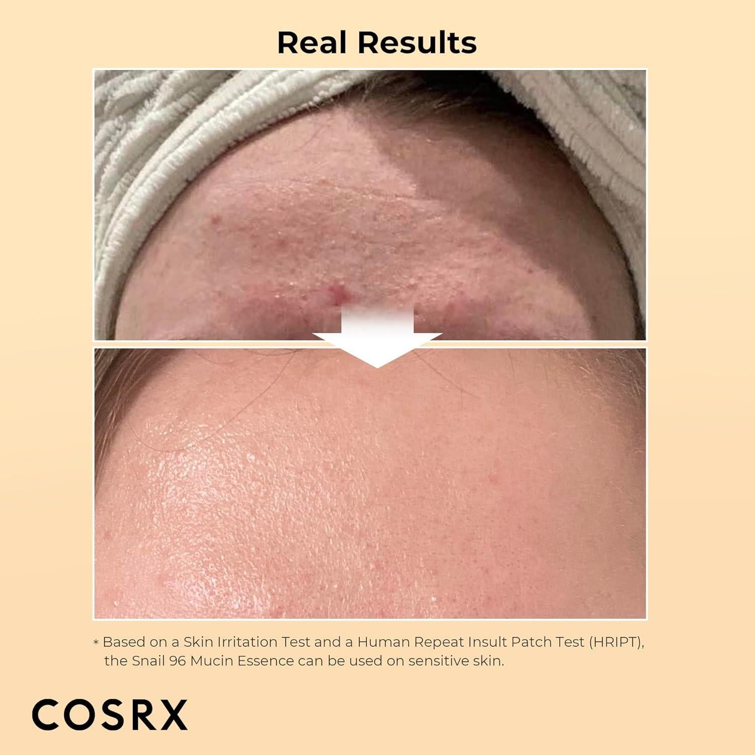 [COSRX] Advanced Snail 96 Mucin Power Essence 100ml