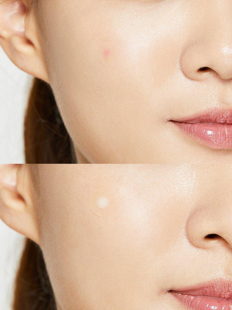 [COSRX] Acne Pimple Master Patch 24ea